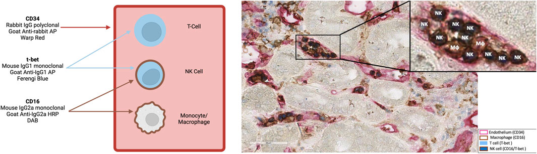 Frontiers Publishing Partnerships | Natural Killer Cell Presence