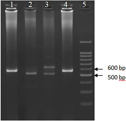 bjbs-79-10526-g002.jpg